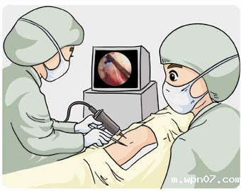 人体植入医疗器械封口洁净要求